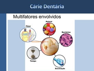 Multifatores envolvidos 
Flúor 
 