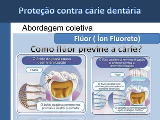 Abordagem coletiva 
Flúor ( Íon Fluoreto) 
 