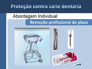 Abordagem Individual 
Remoção profissional de placa 
 