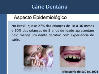 Aspecto Epidemiológico 
No Brasil, quase 27% das crianças de 18 a 36 meses 
e 60% das crianças de 5 anos de idade apresentam 
pelo menos um dente decíduo com experiência de 
cárie. 
Ministério do Saúde, 2003 
 