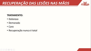 RECUPERAÇÃO DAS LESÕES NAS MÃOS
TRATAMENTO:
• Doloroso
• Demorado
• Caro
• Recuperação nunca é total
 