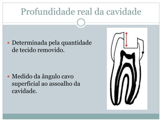 Profundidade real da cavidade


 Determinada pela quantidade
 de tecido removido.



 Medido da ângulo cavo
 superficial ao assoalho da
 cavidade.
 