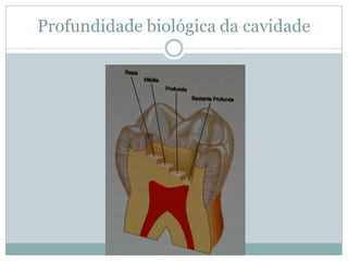 Profundidade biológica da cavidade
 