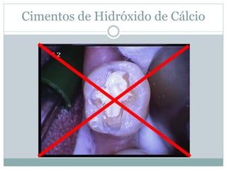 Cimentos de Hidróxido de Cálcio
 