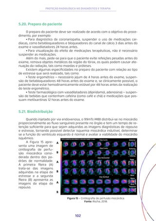 102
PROTEÇÃO RADIOLÓGICA NO DIAGNÓSTICO E TERAPIA
5.20. Preparo do paciente
O preparo do paciente deve ser realizado de acordo com o objetivo do proce-
dimento, por exemplo:
•	
Para diagnóstico de coronariopatia, suspender o uso de medicações car-
díacas, como betabloqueadores e bloqueadores do canal de cálcio 3 dias antes do
exame e vasodilatadores 24 horas antes.
•	Para visualização do efeito de medicações terapêuticas, não é necessário
suspender as medicações.
Além do mais, pede-se para que o paciente evite refeições pesadas antes do
exame, remova objetos metálicos da região do tórax, os quais podem causar ate-
nuação da radiação, tais como moedas e próteses.
Existem algumas especificidades no preparo do paciente com relação ao tipo
de estresse que será realizado, tais como:
•	Teste ergométrico − necessário jejum de 4 horas antes do exame, suspen-
são de betabloqueadores 48 horas antes do exame e, se clinicamente possível, o
paciente deve estar hemodinamicamente estável por 48 horas antes da realização
do teste ergométrico.
•	Teste farmacológico com vasodilatadores (dipiridamol, adenosina) − suspen-
são de bebidas que contenham cafeína (como café e chá) e medicações que pos-
suam metilxantinas 12 horas antes do exame.
5.21. Biodistribuição
Quando injetado por via endovenosa, o 99mTc-MIBI distribui-se no miocárdio
proporcionalmente ao fluxo sanguíneo presente no órgão e tem um tempo de re-
tenção suficiente para que sejam adquiridas as imagens diagnósticas de repouso
e estresse, tornando possível detectar isquemia miocárdica indutível, determinar
se a função do ventrículo esquerdo é normal e avaliar a viabilidade do miocárdio
isquêmico.
A Figura 15 apre-
senta uma imagem de
cintilografia de perfu-
são miocárdica consi-
derada dentro dos pa-
drões de normalidade.
A primeira fileira (A)
trata-se das imagens
adquiridas na etapa de
estresse e a segunda
fileira (B) apresenta as
imagens da etapa de
repouso.
Figura 15 − Cintilografia de perfusão miocárdica.
Fonte: Rocha, 2018.
 