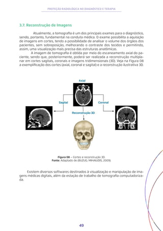 49
PROTEÇÃO RADIOLÓGICA NO DIAGNÓSTICO E TERAPIA
3.7. Reconstrução de Imagens
Atualmente, a tomografia é um dos principais exames para o diagnóstico,
sendo, portanto, fundamental na conduta médica. O exame possibilita a aquisição
de imagens em cortes, tendo a possibilidade de analisar o volume dos órgãos dos
pacientes, sem sobreposição, melhorando o contraste dos tecidos e permitindo,
assim, uma visualização mais precisa das estruturas anatômicas.
A imagem de tomografia é obtida por meio do escaneamento axial do pa-
ciente, sendo que, posteriormente, poderá ser realizada a reconstrução multipla-
nar em cortes sagitais, coronais e imagens tridimensionais (3D). Veja na Figura 08
a exemplificação dos cortes (axial, coronal e sagital) e a reconstrução ilustrativa 3D.
Figura 08 – Cortes e reconstrução 3D.
Fonte: Adaptado de (BUZUG; MIHAILIDIS, 2009).
Existem diversos softwares destinados à visualização e manipulação de ima-
gens médicas digitais, além da estação de trabalho de tomografia computadoriza-
da.
 