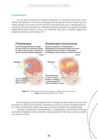 82
PROTEÇÃO RADIOLÓGICA NO DIAGNÓSTICO E TERAPIA
Protonterapia
O uso desta terapia por prótons apresenta um grande avanço nos trata-
mentos de cânceres. As imensas vantagens da terapia por prótons seriam que os
feixes atingem os tumores de forma mais concentrada do que a radioterapia con-
vencional. Na protonterapia são utilizadas partículas pesadas que perdem energia
rapidamente após atingir o tumor, não havendo risco para os tecidos adjacentes
posteriormente ao tumor (Figura 17).
Figura 17 – Diferenças entre protonterapia e radioterapia convencional.
Fonte: Adaptado de (SUIT et al., 2010).
A tecnologia da protonterapia permite a entrega de altas doses com extrema
precisão no volume alvo tumoral, reduzindo os danos no tecido saudável adjacen-
te. Porém, atualmente o Brasil não possui nenhum aparelho de protonterapia.
	 Quando comparada à protonterapia, a radioterapia convencional entrega
uma dose terapêutica menor, devido à incapacidade de restringir a dose somente
no volume tumoral.
 