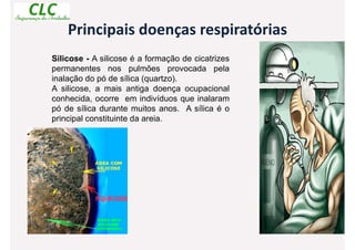 Principais doenças respiratórias
Silicose - A silicose é a formação de cicatrizes
permanentes nos pulmões provocada pela
inalação do pó de sílica (quartzo).
A silicose, a mais antiga doença ocupacional
conhecida, ocorre em indivíduos que inalaram
pó de sílica durante muitos anos. A sílica é o
principal constituinte da areia.
 