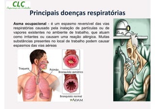 Principais doenças respiratórias
Asma ocupacional - é um espasmo reversível das vias
respiratórias causado pela inalação de partículas ou de
vapores existentes no ambiente de trabalho, que atuam
como irritantes ou causam uma reação alérgica. Muitas
substâncias presentes no local de trabalho podem causar
espasmos das vias aéreas
 