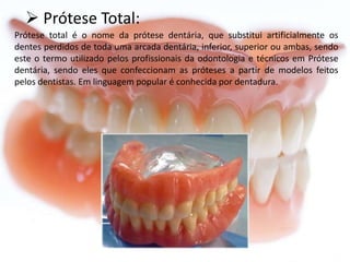  Prótese Total:
Prótese total é o nome da prótese dentária, que substitui artificialmente os
dentes perdidos de toda uma arcada dentária, inferior, superior ou ambas, sendo
este o termo utilizado pelos profissionais da odontologia e técnicos em Prótese
dentária, sendo eles que confeccionam as próteses a partir de modelos feitos
pelos dentistas. Em linguagem popular é conhecida por dentadura.

 