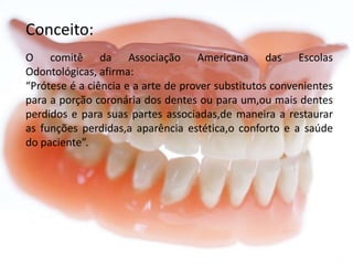 Conceito:
O comitê da Associação Americana das Escolas
Odontológicas, afirma:
“Prótese é a ciência e a arte de prover substitutos convenientes
para a porção coronária dos dentes ou para um,ou mais dentes
perdidos e para suas partes associadas,de maneira a restaurar
as funções perdidas,a aparência estética,o conforto e a saúde
do paciente”.

 