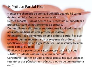  Prótese Parcial Fixa:
– antes era chamada de ponte, é utilizada quando há vários
dentes perdidos. Seus componentes são:
Dentes suporte – são os dentes que sustentam ou suportam a
prótese. Situam-se nos extremos da prótese.
Dentes pilares – são dentes suportes, mas localizados numa
área intermediária de uma prótese parcial fixa.
Retentores – são elementos de uma prótese parcial fixa que
unem os dentes suportes a parte suspensa da prótese
(pôntico) e o retém no lugar. Pode ser uma restauração, uma
coroa parcial ou total.
Pônticos – é a parte suspensa da prótese parcial fixa que
substitui os dentes naturais que foram perdidos.
Conectores – partes de uma prótese parcial fixa que unem os
retentores aos pônticos, um pôntico a outro ou um retentor a
outro.

 