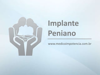 www.medicoimpotencia.com.br
Implante
Peniano
 