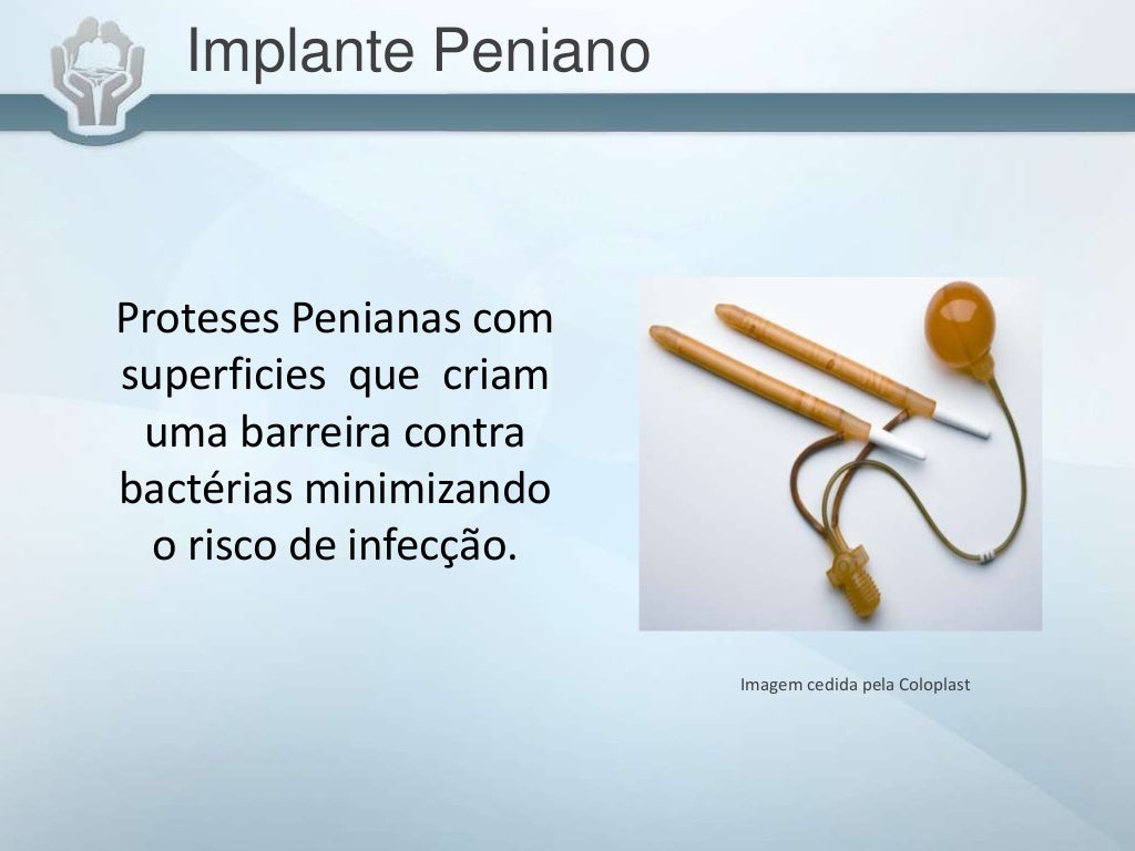 Como é Feita A Cirurgia De Prótese Peniana Protese Peniana