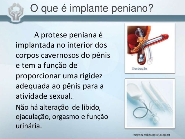 Protese Peniana