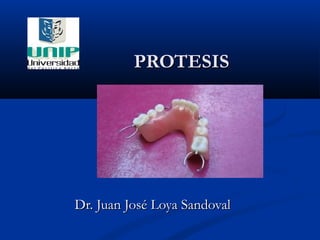 PROTESISPROTESIS
Dr. Juan José Loya SandovalDr. Juan José Loya Sandoval
 