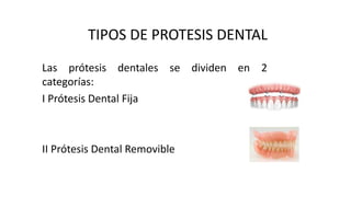 TIPOS DE PROTESIS DENTAL
Las prótesis dentales se dividen en 2
categorías:
I Prótesis Dental Fija
II Prótesis Dental Removible
 