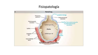 Fisiopatología
 