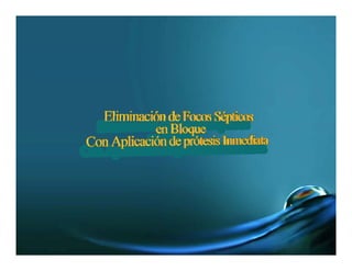 Protesis Inmediata Dental