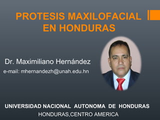 PROTESIS MAXILOFACIAL
EN HONDURAS
Dr. Maximiliano Hernández
UNIVERSIDAD NACIONAL AUTONOMA DE HONDURAS
HONDURAS,CENTRO AMERICA
 