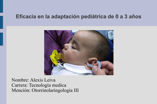 Eficacia en la adaptación pediátrica de 0 a 3 años Nombre: Alexis Leiva Carrera: Tecnología medica Mención: Otorrinolaringologia III 
