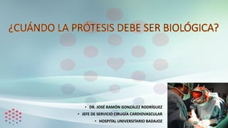 • DR. JOSÉ RAMÓN GONZÁLEZ RODRÍGUEZ
• JEFE DE SERVICIO CIRUGÍA CARDIOVASCULAR
• HOSPITAL UNIVERSITARIO BADAJOZ
 