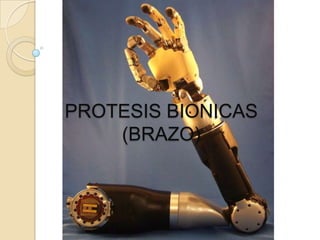 PROTESIS BIONICAS
(BRAZO)

 