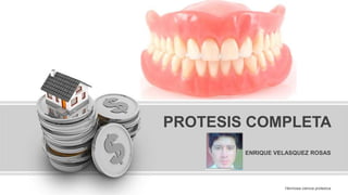 ENRIQUE VELASQUEZ ROSAS
PROTESIS COMPLETA
Hermosa ciencia protesica
 