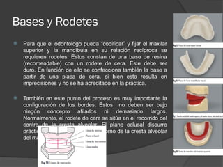 PROTESIS COMPLETA caracteristica (3) (1).pptx