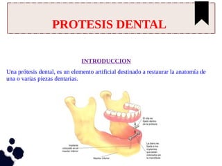 INTRODUCCION
Una prótesis dental, es un elemento artificial destinado a restaurar la anatomía de
una o varias piezas dentarias.
PROTESIS DENTAL
 