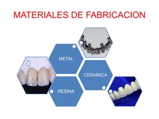 MATERIALES DE FABRICACION
RESINA
CERAMICA
METAL
 