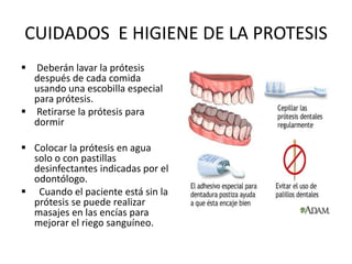 CUIDADOS E HIGIENE DE LA PROTESIS
 Deberán lavar la prótesis
  después de cada comida
  usando una escobilla especial
  para prótesis.
 Retirarse la prótesis para
  dormir

 Colocar la prótesis en agua
  solo o con pastillas
  desinfectantes indicadas por el
  odontólogo.
 Cuando el paciente está sin la
  prótesis se puede realizar
  masajes en las encías para
  mejorar el riego sanguíneo.
 