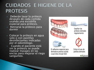     Deberán lavar la prótesis
    después de cada comida
    usando una escobilla
    especial para prótesis.
    Retirarse la prótesis para
    dormir

   Colocar la prótesis en agua
    solo o con pastillas
    desinfectantes indicadas
    por el odontólogo.
    Cuando el paciente está
    sin la prótesis se puede
    realizar masajes en las
    encías para mejorar el riego
    sanguíneo.
 