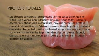 PROTESIS TOTALES
• Las prótesis completas son necesarias en los casos en los que no
faltan una o varias piezas dentales sino que faltan todas. Como es
necesario sustituir toda la dentadura, hay que hacer una prótesis
completa de los dientes. Existen diferentes tipos de prótesis dentales
completas. Por un lado, están las dentaduras postizas y por otro lado
nos encontramos con los implantes dentales completos. Es decir,
cuando se realizan implantes para todas y cada una de las piezas
dentales de la boca.
 