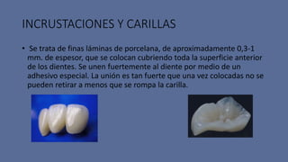 INCRUSTACIONES Y CARILLAS
• Se trata de finas láminas de porcelana, de aproximadamente 0,3-1
mm. de espesor, que se colocan cubriendo toda la superficie anterior
de los dientes. Se unen fuertemente al diente por medio de un
adhesivo especial. La unión es tan fuerte que una vez colocadas no se
pueden retirar a menos que se rompa la carilla.
 