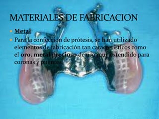  Metal
 Para la confección de prótesis, se han utilizado
 elementos de fabricación tan característicos como
 el oro, metal precioso de uso muy extendido para
 coronas y puentes.
 