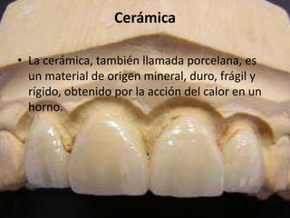 Cerámica

• La cerámica, también llamada porcelana, es
  un material de origen mineral, duro, frágil y
  rígido, obtenido por la acción del calor en un
  horno.
 