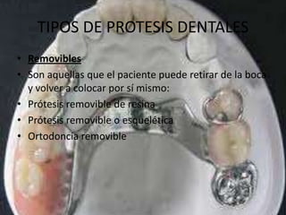 TIPOS DE PROTESIS DENTALES
• Removibles
• Son aquellas que el paciente puede retirar de la boca
  y volver a colocar por sí mismo:
• Prótesis removible de resina
• Prótesis removible o esquelética
• Ortodoncia removible
 