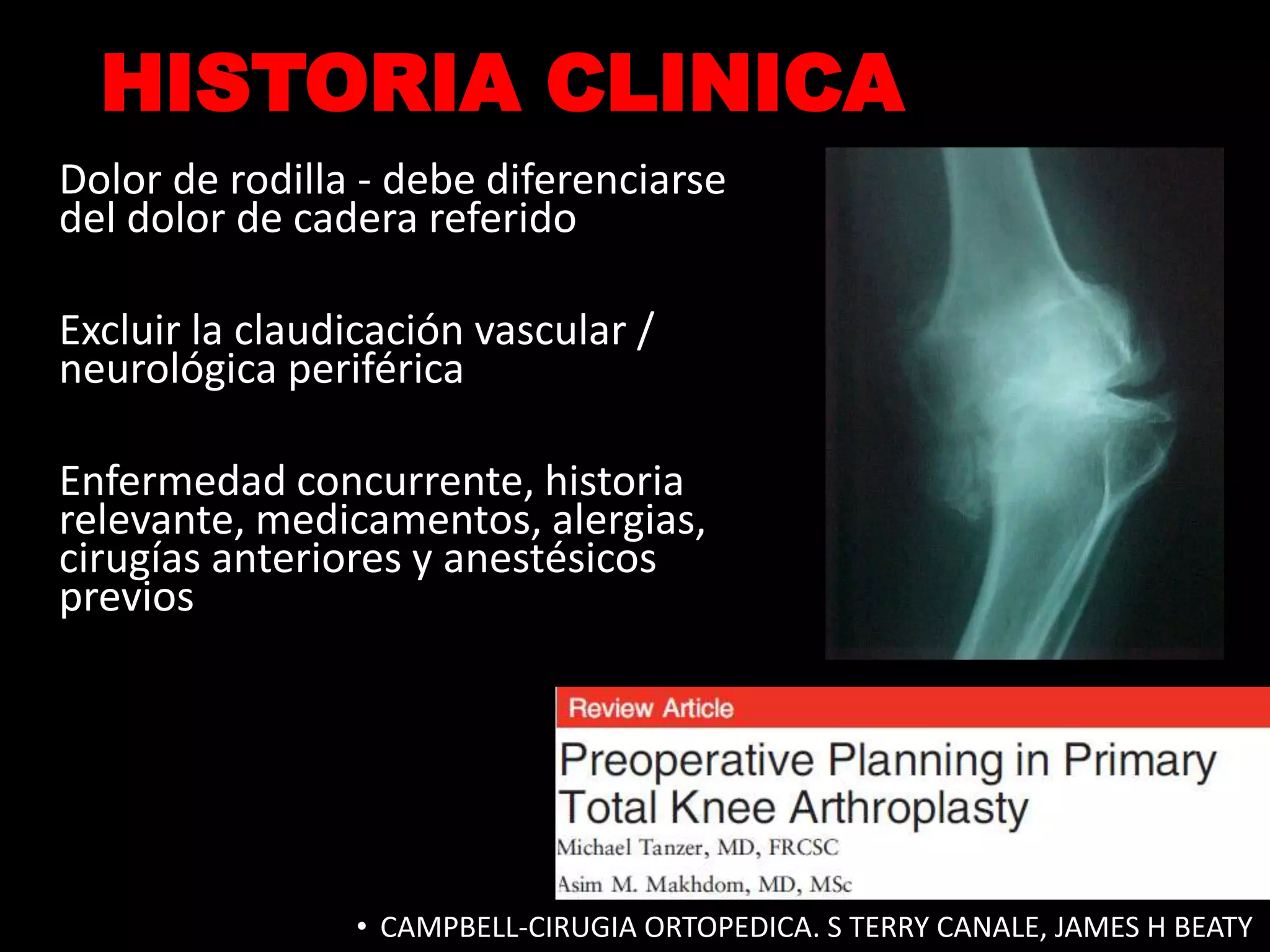 Protesis de rodilla | PPTX