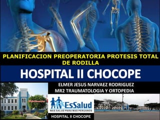 HOSPITAL II CHOCOPE
PLANIFICACION PREOPERATORIA PROTESIS TOTAL
DE RODILLA
ELMER JESUS NARVAEZ RODRIGUEZ
MR2 TRAUMATOLOGIA Y ORTOPEDIA
 