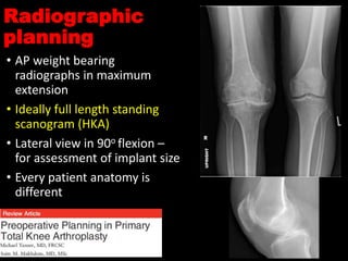 Protesis de rodilla | PPTX