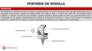 DEFINICIÓN:
PORTESIS DE RODILLA
Se clasifican en función de cómo se realice la sustitución de los huesos afectados, pero las más habituales son las
conocidas como prótesis totales de rodilla (PTR). Las PTR se fijan a la tibia por medio de una bandeja tibial
metálica y al fémur a través de unos cóndilos, también metálicos. Entre ambos se sitúa una pieza llamada inserto
y fabricada de un plástico (polietileno) que facilita la articulación de fémur y tibia. Si el cirujano lo considera
oportuno, también puede sustituir la parte articular de la rótula por un componente de polietileno.
 