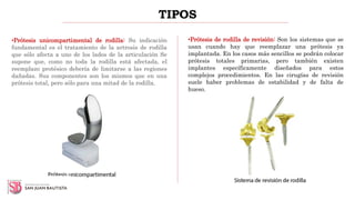 TIPOS
•Prótesis unicompartimental de rodilla: Su indicación
fundamental es el tratamiento de la artrosis de rodilla
que sólo afecta a uno de los lados de la articulación Se
supone que, como no toda la rodilla está afectada, el
reemplazo protésico debería de limitarse a las regiones
dañadas. Sus componentes son los mismos que en una
prótesis total, pero sólo para una mitad de la rodilla.
•Prótesis de rodilla de revisión: Son los sistemas que se
usan cuando hay que reemplazar una prótesis ya
implantada. En los casos más sencillos se podrán colocar
prótesis totales primarias, pero también existen
implantes específicamente diseñados para estos
complejos procedimientos. En las cirugías de revisión
suele haber problemas de estabilidad y de falta de
hueso.
 