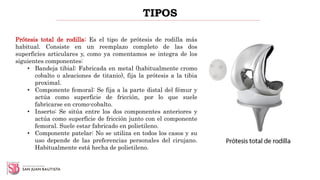 TIPOS
Prótesis total de rodilla: Es el tipo de prótesis de rodilla más
habitual. Consiste en un reemplazo completo de las dos
superficies articulares y, como ya comentamos se integra de los
siguientes componentes:
• Bandeja tibial: Fabricada en metal (habitualmente cromo
cobalto o aleaciones de titanio), fija la prótesis a la tibia
proximal.
• Componente femoral: Se fija a la parte distal del fémur y
actúa como superficie de fricción, por lo que suele
fabricarse en cromo-cobalto.
• Inserto: Se sitúa entre los dos componentes anteriores y
actúa como superficie de fricción junto con el componente
femoral. Suele estar fabricado en polietileno.
• Componente patelar: No se utiliza en todos los casos y su
uso depende de las preferencias personales del cirujano.
Habitualmente está hecha de polietileno.
 