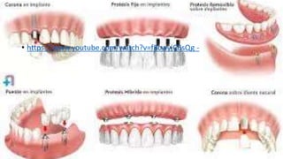 • https://www.youtube.com/watch?v=f8cwyjCBsQg -
 