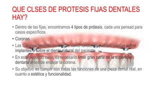 QUE CLSES DE PROTESIS FIJAS DENTALES
HAY?
• Dentro de las fijas, encontramos 4 tipos de prótesis, cada una pensad para
casos específicos.
• Coronas
• Las Coronas también conocidas como fundas se pueden colocar sobre
implantes o sobre el diente natural del paciente.
• En este segundo caso, es necesario limar gran parte de la superficie
dentaria antes de encajar la corona.
• Su objetivo es cumplir con todas las funciones de una pieza dental real, en
cuanto a estética y funcionalidad.
 