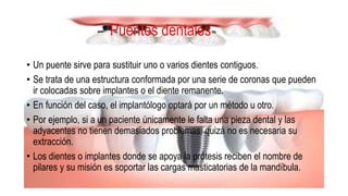Puentes dentales
• Un puente sirve para sustituir uno o varios dientes contiguos.
• Se trata de una estructura conformada por una serie de coronas que pueden
ir colocadas sobre implantes o el diente remanente.
• En función del caso, el implantólogo optará por un método u otro.
• Por ejemplo, si a un paciente únicamente le falta una pieza dental y las
adyacentes no tienen demasiados problemas, quizá no es necesaria su
extracción.
• Los dientes o implantes donde se apoya la prótesis reciben el nombre de
pilares y su misión es soportar las cargas masticatorias de la mandíbula.
 