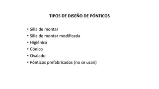 TIPOS DE DISEÑO DE PÓNTICOS 
• Silla de montar 
• Silla de montar modificada 
• Higiénica 
• Cónico 
• Ovalado 
• Pónticos prefabricados (no se usan) 
 