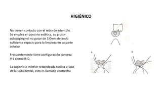 HIGIÉNICO 
No tienen contacto con el reborde edentúlo. 
Se emplea en zona no estética, su grosor 
oclusogingival no pasar de 3.0mm dejando 
suficiente espacio para la limpieza en su parte 
inferior. 
Frecuentemente tiene configuración convexa 
V-L como M-D. 
La superficie inferior redondeada facilita el uso 
de la seda dental, esto es llamado ventrecha 
 