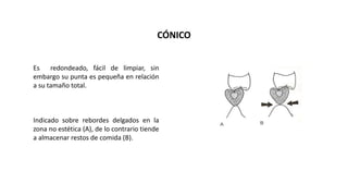 CÓNICO 
Es redondeado, fácil de limpiar, sin 
embargo su punta es pequeña en relación 
a su tamaño total. 
Indicado sobre rebordes delgados en la 
zona no estética (A), de lo contrario tiende 
a almacenar restos de comida (B). 
 